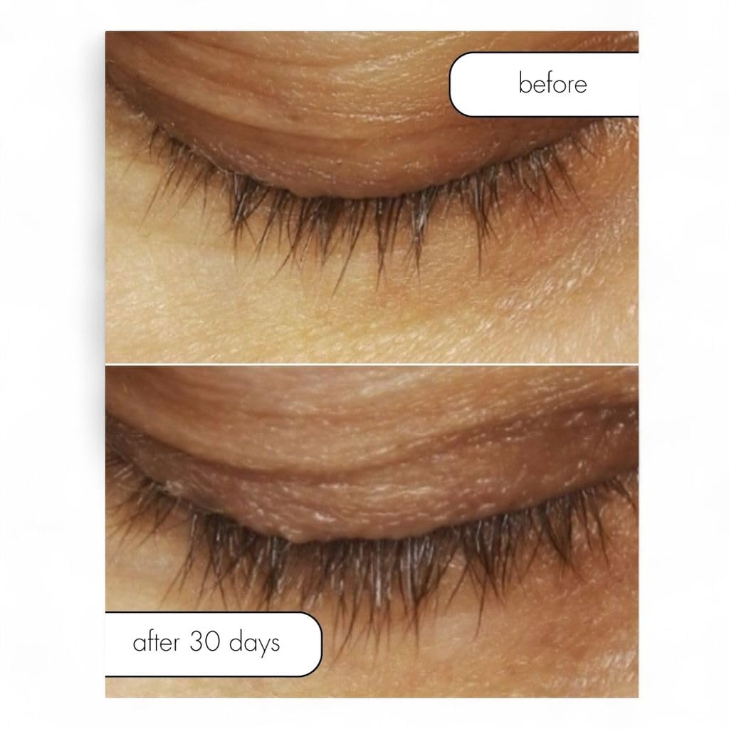 Serious Skincare Lash Bath & Conditioner - Double Action Eye Makeup Remover - Oil Free - Enhancing Peptides Promotes Eyelash Growth - Clover Flower - Effortlessly Removes Waterproof Mascara - 4 oz.