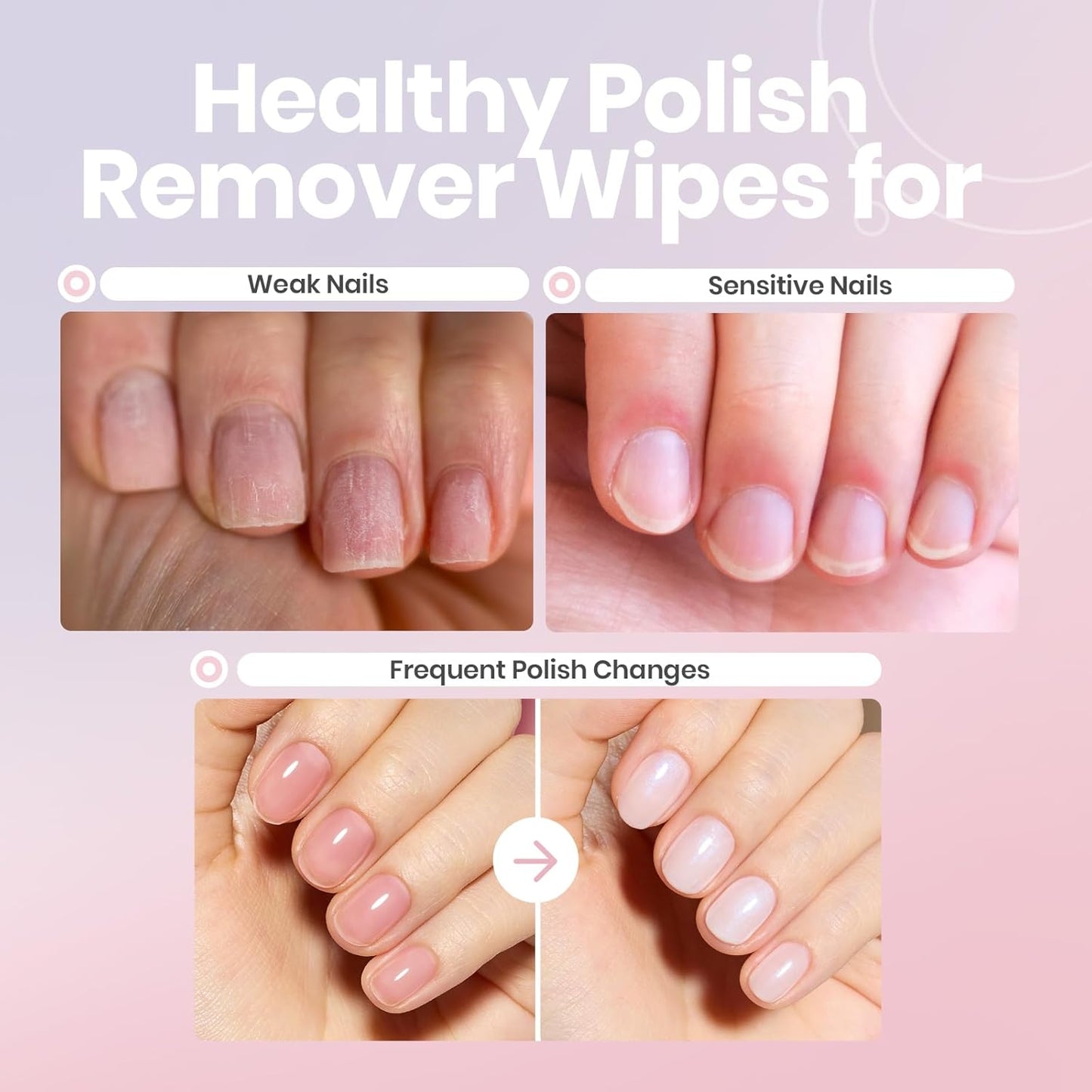 Beetles Non Acetone Nail Polish Remover - 0.67Fl Oz/20ML Nourishing Formula Acetone Free Nail Polish Remover - Non-Drying - Professional Quick and Gentle Removal for Natural Damaged Nails